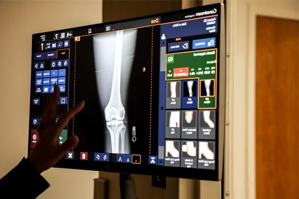 An x-ray diagram on a computer monitor